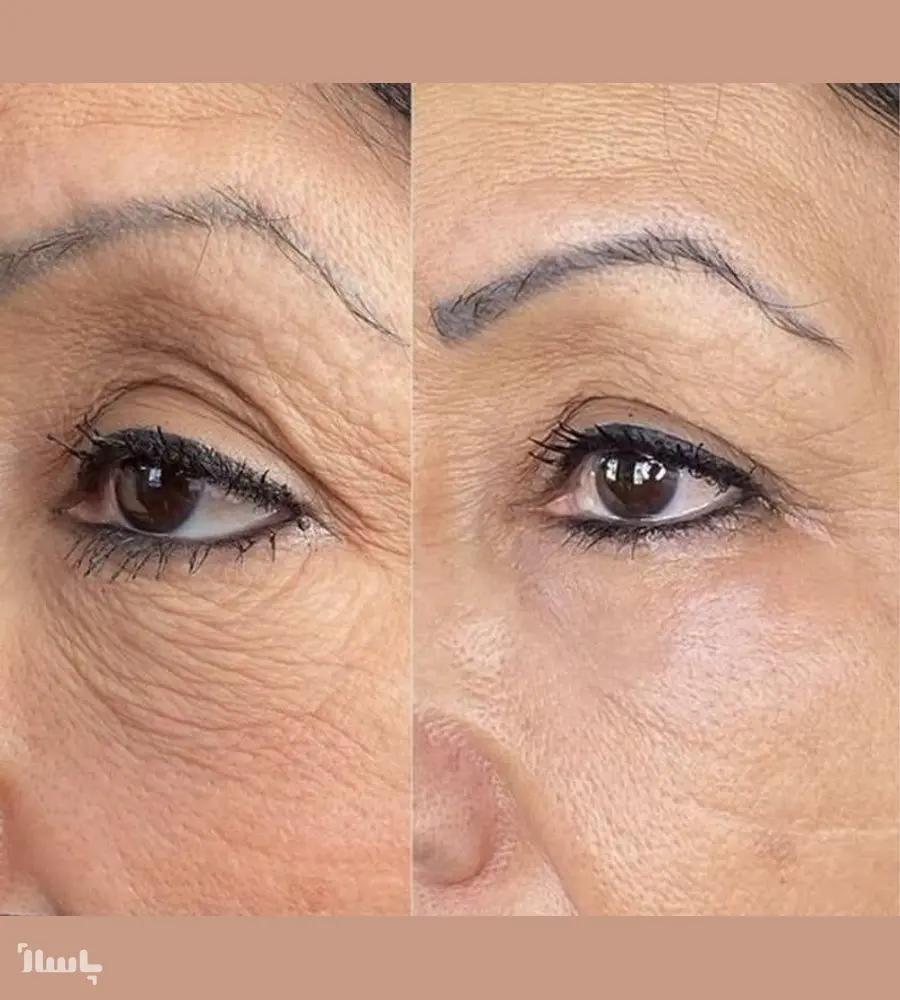 جزئیات محصول روشن کننده و ضدلک بیوممتیک