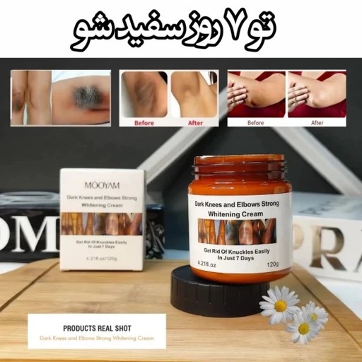 کرم ضد لک بیکینی خارجی