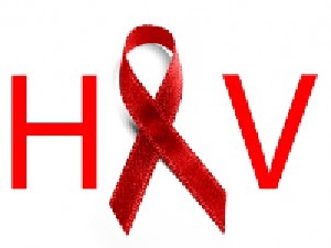 تحقیق – HIV ایدز