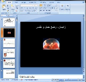 دانلود پاورپوینت زايمان- 94 اسلاید