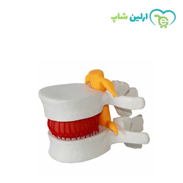 مولاژ مهره های دیسک