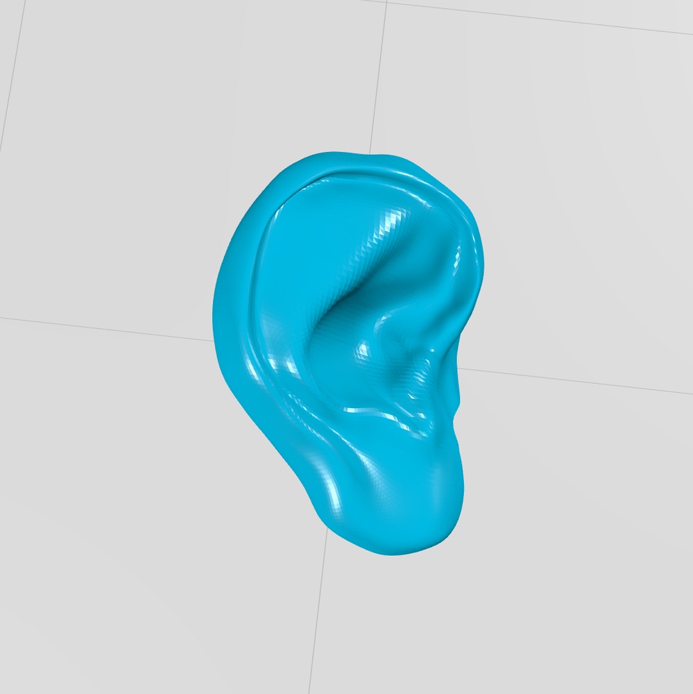 مولاژ گوش خارجی(external ear)