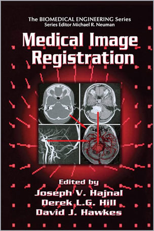 Medical Image Registration
