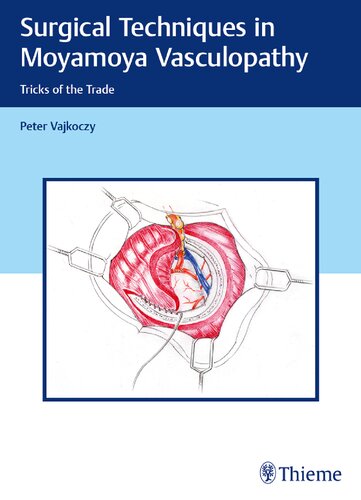 تکنیک های جراحی در واسکولوپاتی مویا مویا: فوت و فن های کار ۲۰۱۹ <br> Surgical Techniques in Moyamoya Vasculopathy: Tricks of the Trade 2019 - کالیبو