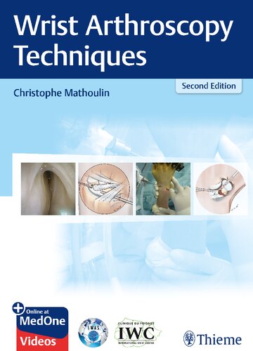 تکنیک های آرتروسکوپی مچ دست ۲۰۱۹ <br> Wrist Arthroscopy Techniques 2019 - کالیبو