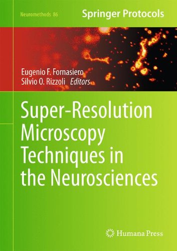 تکنیک های میکروسکوپ ابر-تفکیک پذیری در علوم اعصاب ۲۰۱۴ <br> Super-Resolution Microscopy Techniques in the Neurosciences 2014 - کالیبو