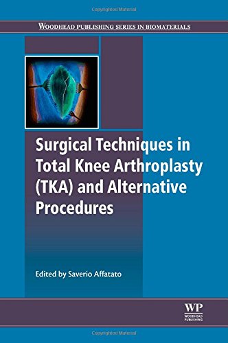 تکنیک های جراحی در آرتروپلاستی کامل زانو و روش های جایگزین ۲۰۱۴ <br> Surgical Techniques in Total Knee Arthroplasty and Alternative Procedures 2014 - کالیبو
