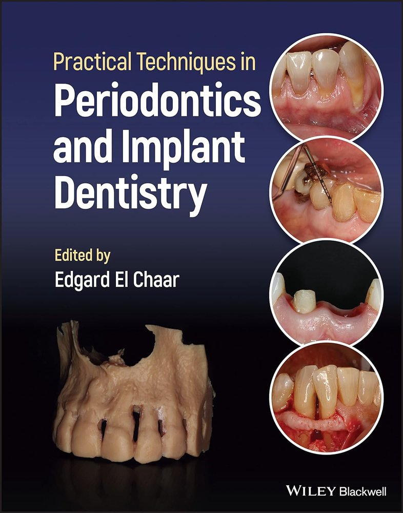 تکنیک های کاربردی در پریودنتیکس و ایمپلنت دندانی ۲۰۲۳ <br> Practical Techniques in Periodontics and Implant Dentistry 2023 - کالیبو