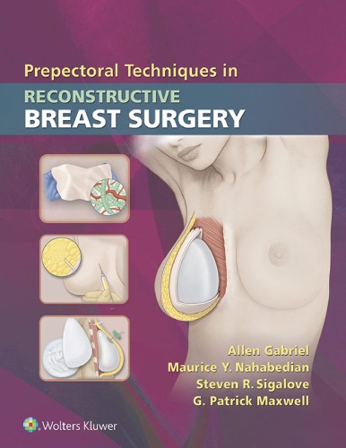 تکنیک های پیش پکتورال در جراحی بازسازی پستان ۲۰۱۸ <br> Prepectoral Techniques in Reconstructive Breast Surgery 2018 - کالیبو