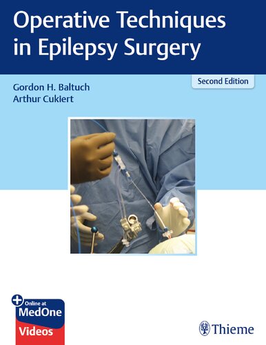 تکنیک های جراحی در جراحی صرع ۲۰۱۹ <br> Operative Techniques in Epilepsy Surgery 2019 - کالیبو