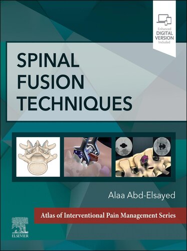 تکنیک های همجوشی ستون فقرات ۲۰۲۳ <br> Spinal Fusion Techniques 2023 - کالیبو