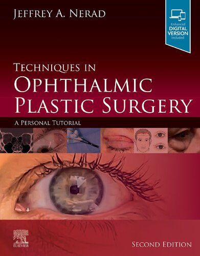 تکنیک های جراحی پلاستیک چشمی: یک آموزش شخصی ۲۰۲۱ <br> Techniques in Ophthalmic Plastic Surgery: A Personal Tutorial 2021 - کالیبو