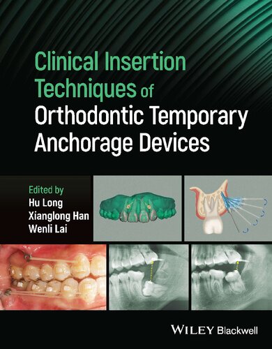 تکنیک های درج بالینی دستگاه های لنگرگاه موقت ارتودنسی ۲۰۲۴ <br> Clinical Insertion Techniques of Orthodontic Temporary Anchorage Devices 2024 - کالیبو