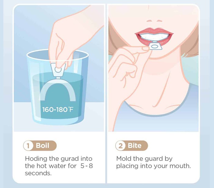 تری بلیچینگ ترموفرم - AV Dental