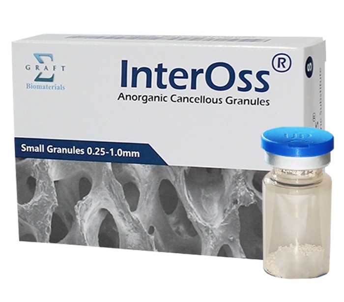 Sigma Graft - InterOss Graft