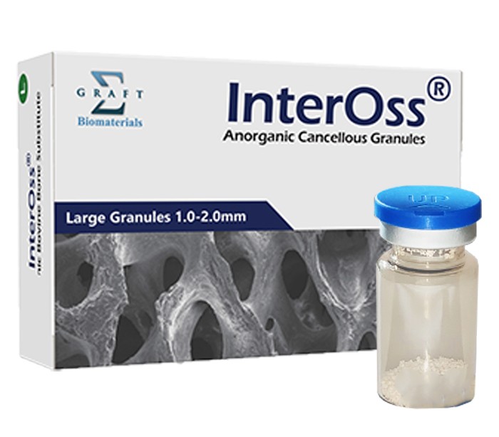 Sigma Graft - InterOss Granule