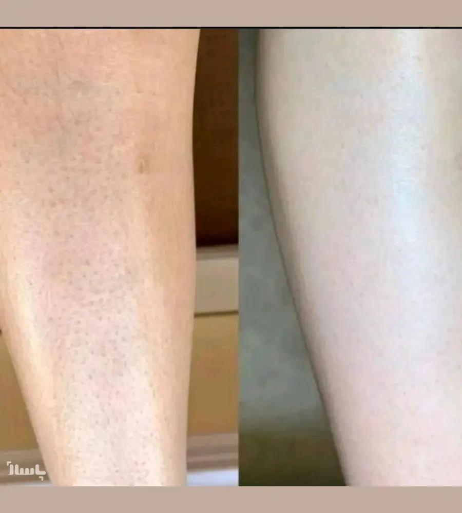 جزئیات محصول نمک بدن آنری