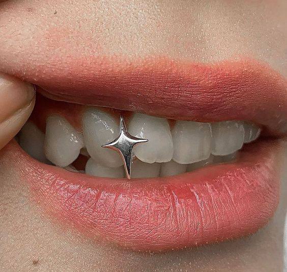 گیریلز دندون شاین