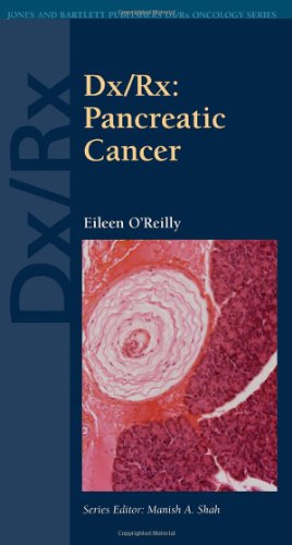 تشخیص: سرطان لوزالمعده، ۲۰۱۰ <br> Dx/Rx: Pancreatic Cancer 2010 - کالیبو