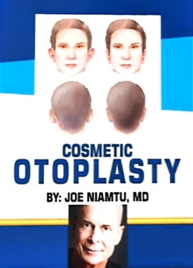 دانلود مجموعه ویدئویی اتوپلاستی زیبایی دکتر جو نیامتو Cosmetic Otoplasty By Dr. Joe Niamtu
