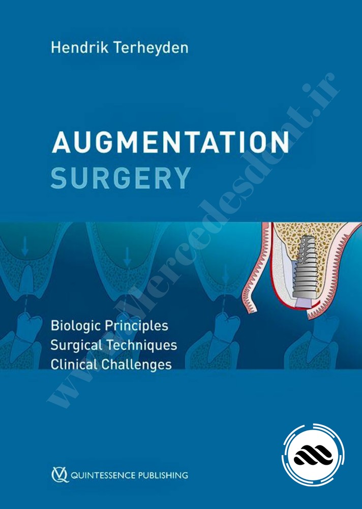 Augmentation Surgery