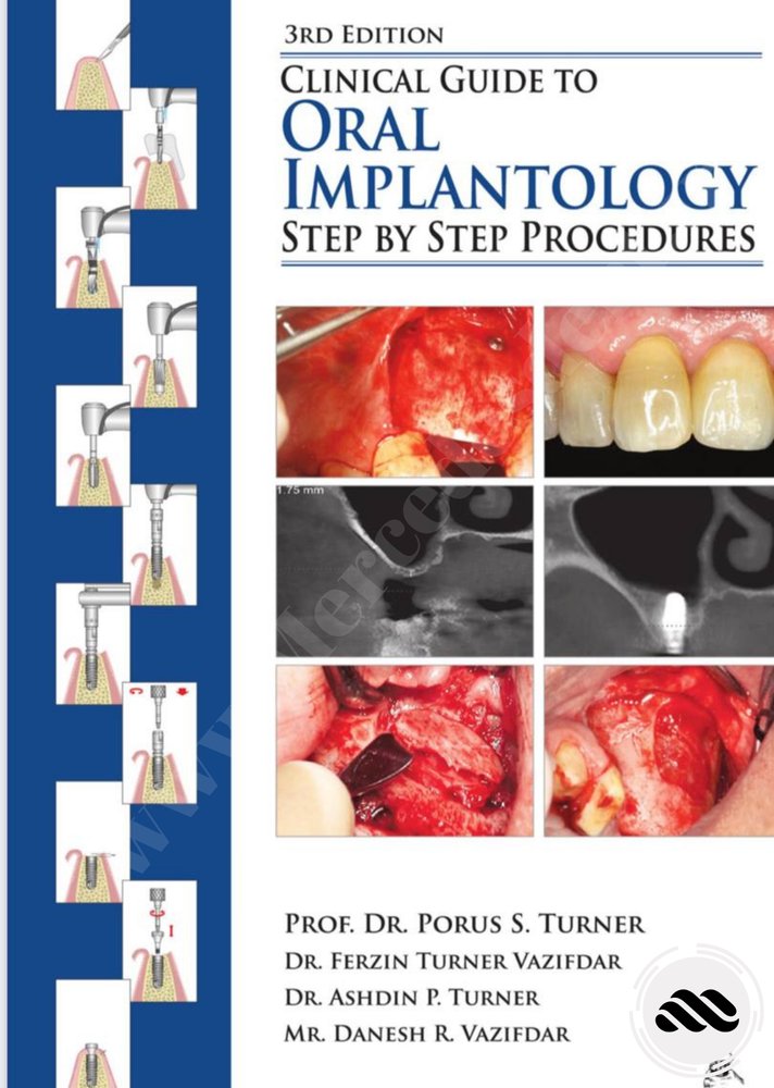 Clinical Guide To Oral Implantology
