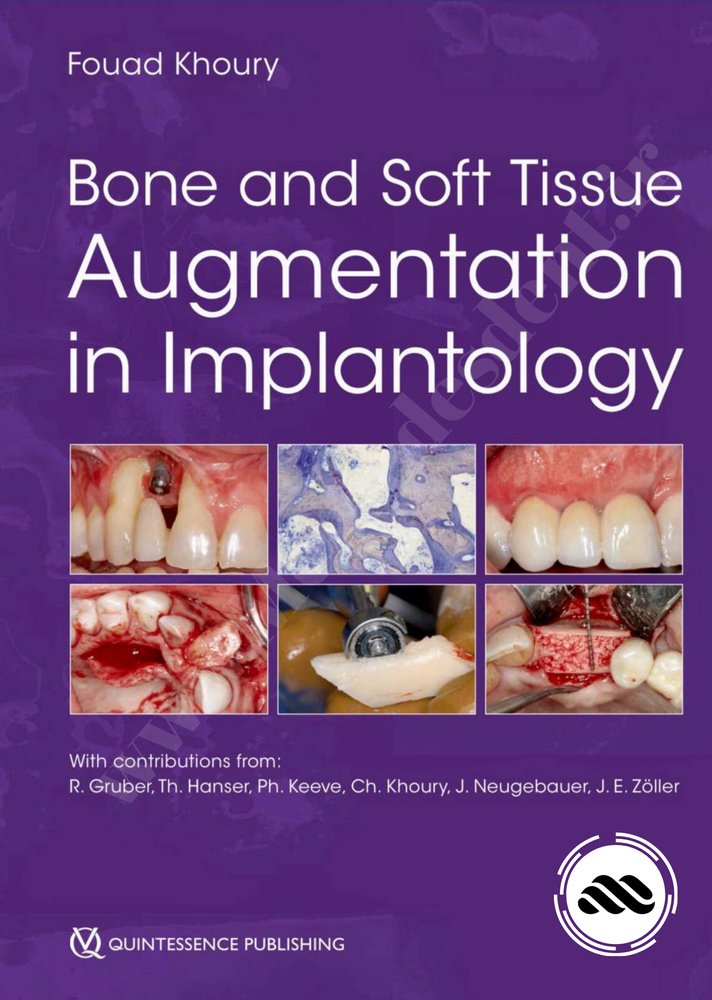 Bone And Soft Tissue Augmentation In Implantology
