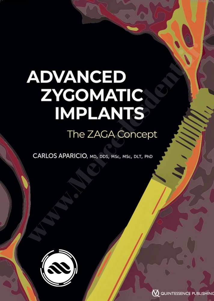 Advanced Zygomatic Implants: The Zaga Concept