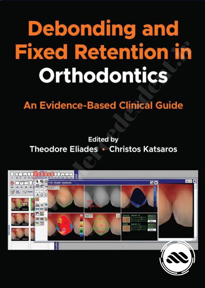 Debonding And Fixed Retention In Orthodontics