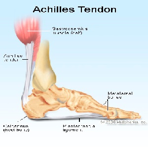 التهاب و پارگی تاندون آشیل Achilles Tendonitis