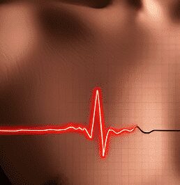 2 جزوه خلاصه اکسترنی ECG - فایلمس