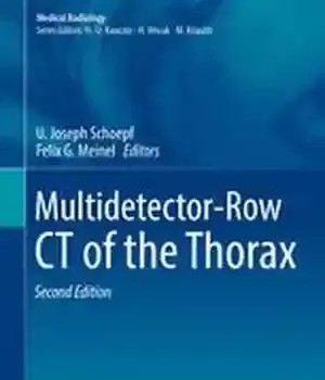 دانلود کتاب Multidetector-Row CT of the Thorax – CT-Row-Row CT از قفسه