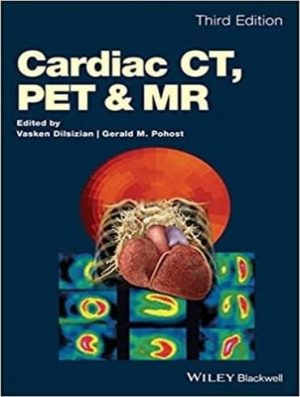 دانلود کتاب Cardiac CT, PET and MR, Second Edition – CT قلب، PET و MR، ویرایش دوم