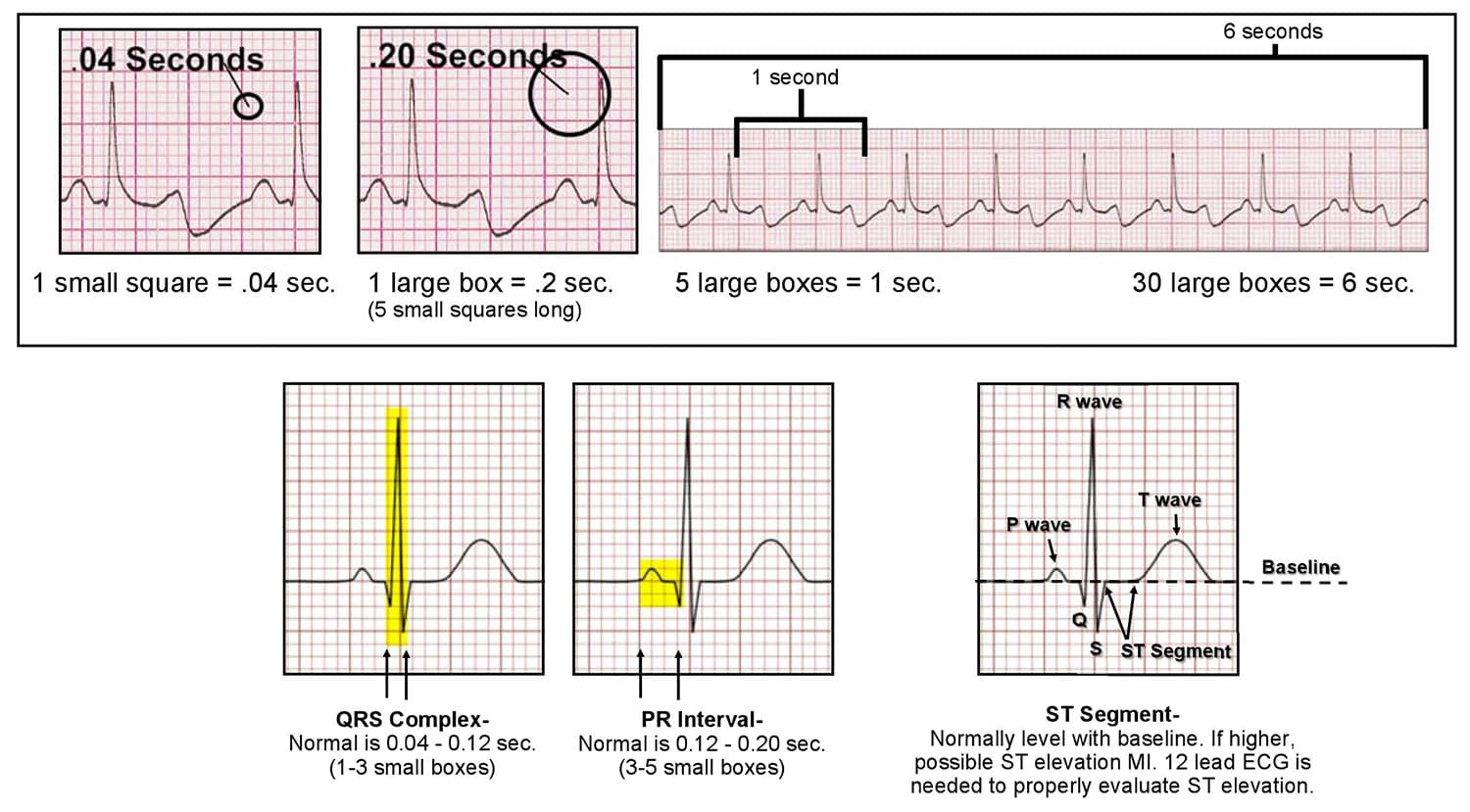 جزوه تفسیر ECG برای پرستاران – دانلود