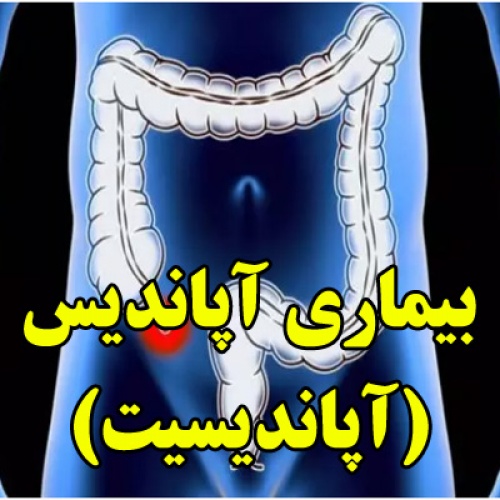 بیماری آپاندیس یا آپاندیسیت - اسمارت فایل