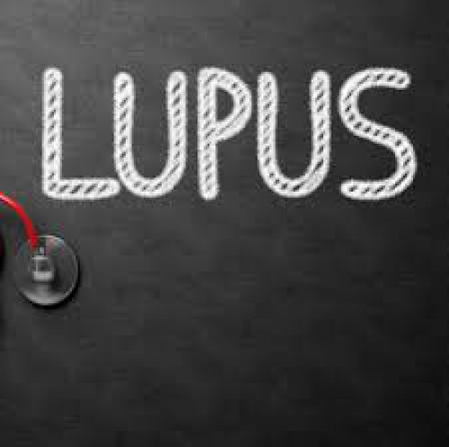 پاورپوینت ارائه بیماری لوپوس (Systemic lupus erythematosus) - اسمارت فایل
