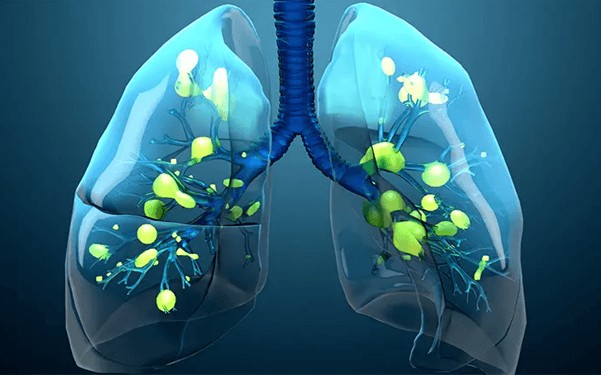 پاورپوینت بیماریهای تنفس COPD ARF ARDS - پاورداک
