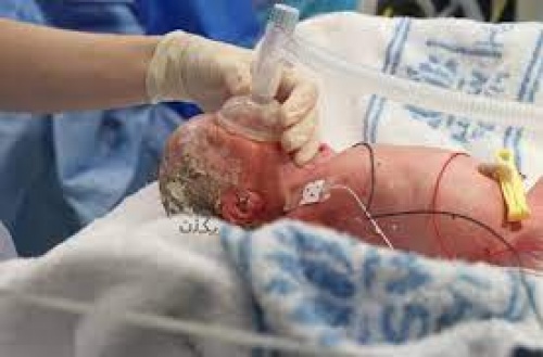 پاورپوینت آماده ارائه کنفرانس احیاء نوزادان (Neonatal resuscitation) - اسمارت فایل