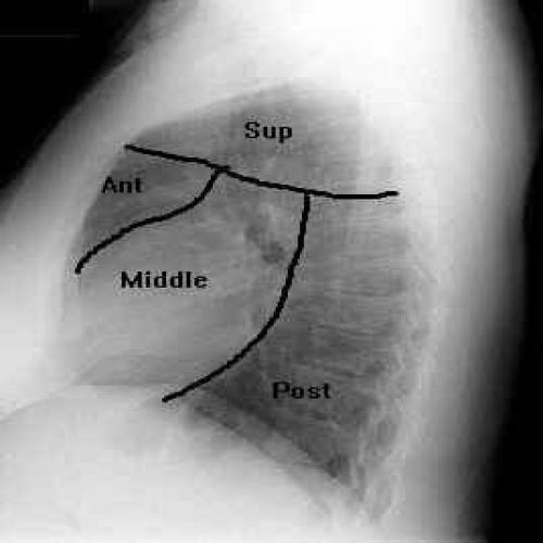 pulmonary edema(ادم حاد ریه) - اسمارت فایل