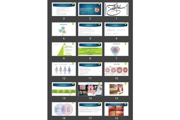 پاورپوینت Diagnosis &amp; treatment Of scleroderma