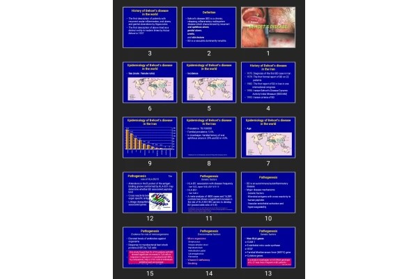 پاورپوینت BEHCET’S DISEASE