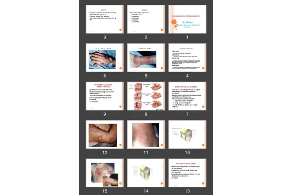 پاورپوینت BURN INJURIES &amp; ITS MANAGEMENT