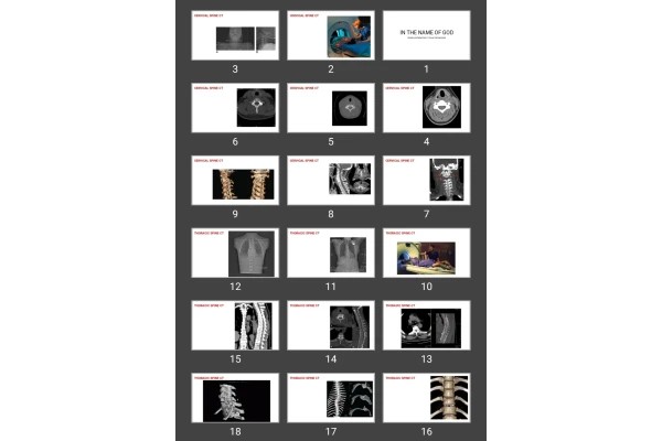 پاورپوینت SPINE &amp; EXTREMITIES CT SCAN TECHNIQUES