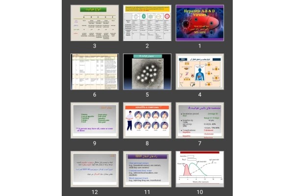 پاورپوینت هپاتیت حاد ویرال Hepatitis A-B &amp; D Viruses