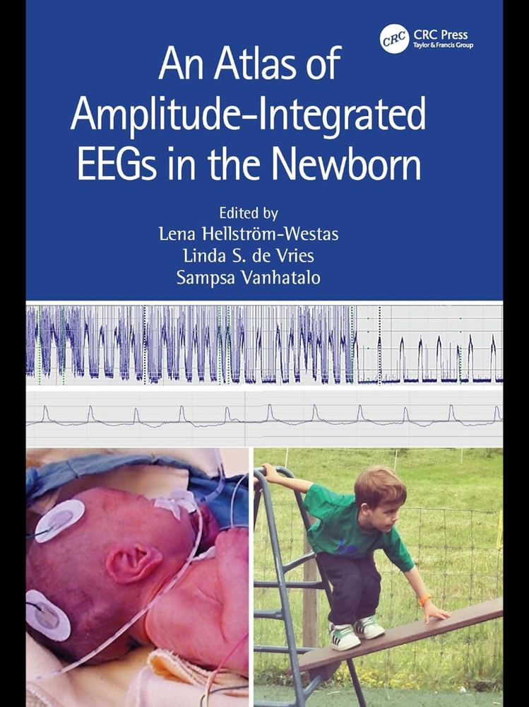 An Atlas of Amplitude-Integrated EEGs in the Newborn 3rd Edition