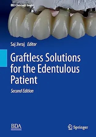 دانلود نسخه کامل کتاب Graftless Solutions for the Edentulous Patient (BDJ Clinician’s Guides)