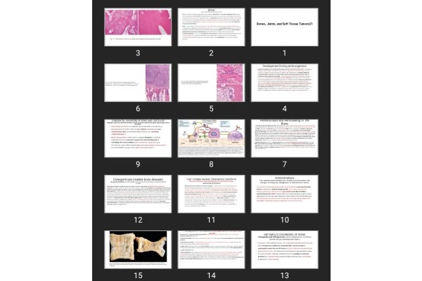 پاورپوینت Bones, Joints, and Soft Tissue Tumors21