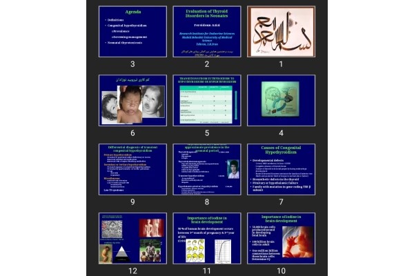 پاورپوینت Evaluation of Thyroid Disorders in Neonates