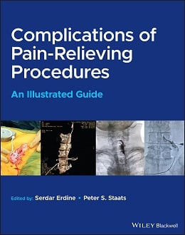 دانلود کتاب عوارض روش های تسکین درد Complications of Pain-Relieving Procedures, 1ed