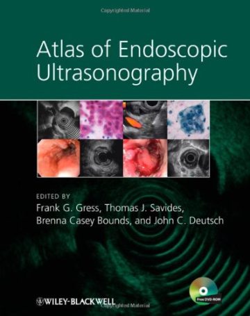 دانلود کتاب اطلس سونوگرافی آندوسکوپی ۲۰۱۱ Atlas of Endoscopic Ultrasonography 2011